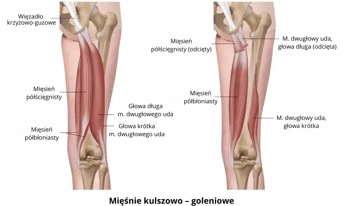 Anatomia mięśni kulszowo-goleniowych, które mogą powodować ból mięśni. Widoczne więzadło krzyżowo-guzowe i mięśnie: półścięgnisty i półbłoniasty.