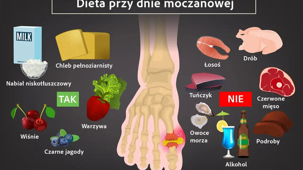 Dieta przy dnie moczanowej: nabiał, chleb, warzywa, owoce (TAK); ryby, drób, czerwone mięso, podroby, alkohol (NIE).