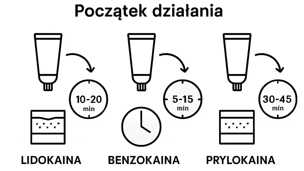 Porównanie czasu działania: lidokaina (10-20 min), benzokaina (5-15 min), prylokaina (30-45 min).