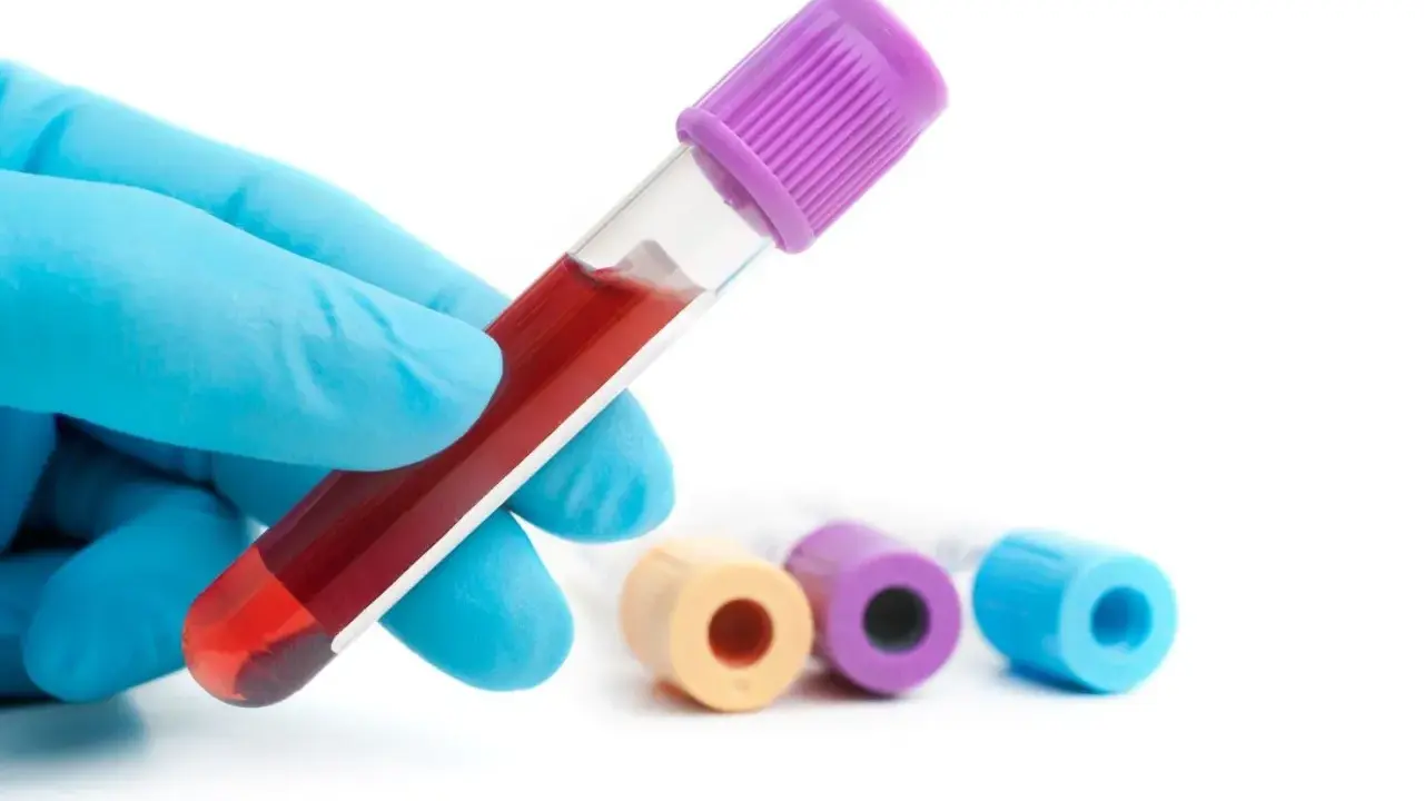 Ręka w niebieskiej rękawiczce trzyma probówkę z krwią do badania poziomu glukozy, np. hba1c.