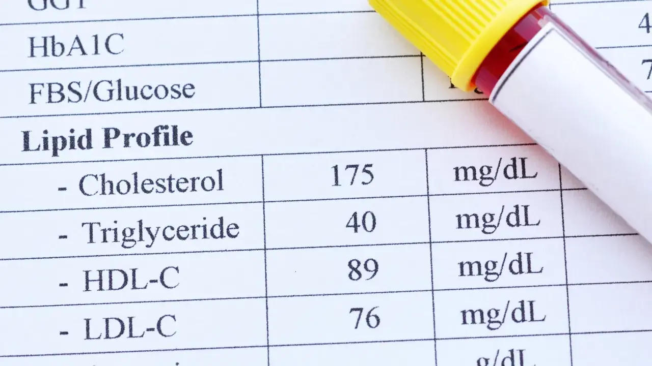 Wyniki lipidogramu: cholesterol 175, trójglicerydy 40, HDL-C 89, LDL-C 76 mg/dL.