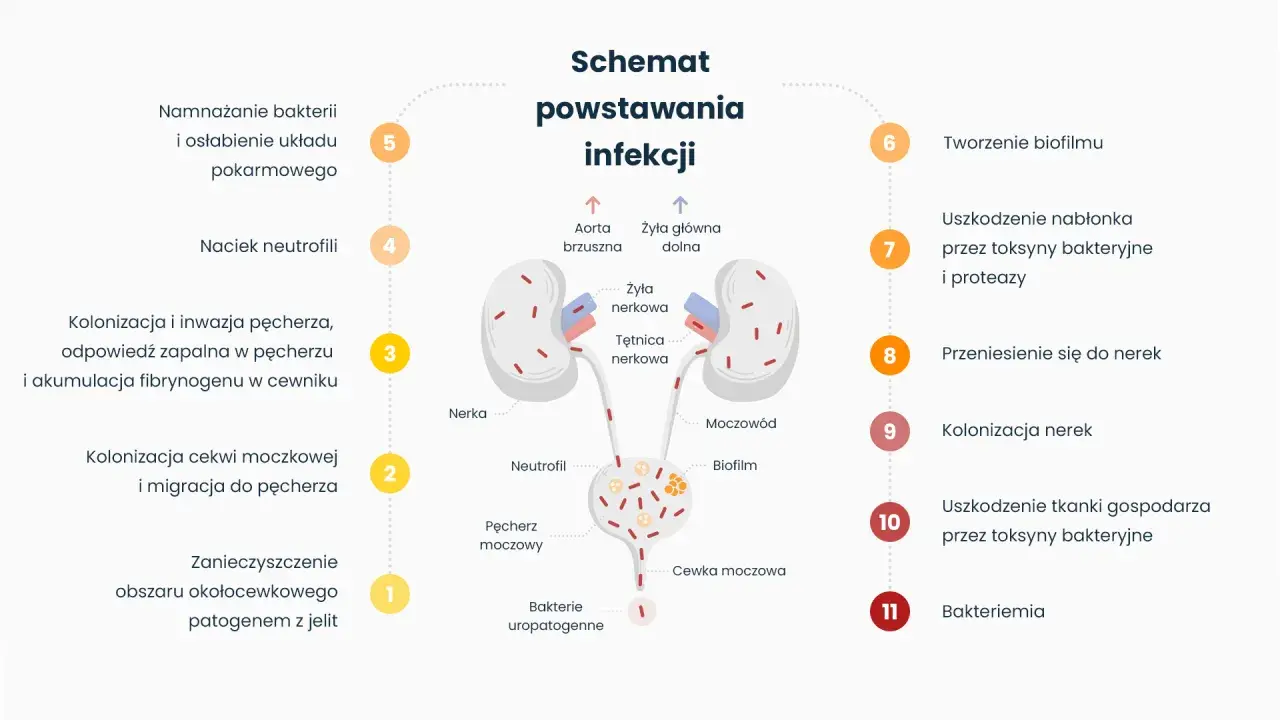Schemat powstawania infekcji dróg moczowych, od kolonizacji bakterii po zapalenie pęcherza i nerek. Leki mogą pomóc w leczeniu tego stanu.
