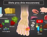 Dieta przy dnie moczanowej: nabiał, chleb, warzywa, owoce (TAK); ryby, drób, czerwone mięso, podroby, alkohol (NIE).