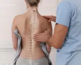 Fizjoterapeuta bada kręgosłup pacjentki, zwracając uwagę na potencjalną kifoza piersiowa.