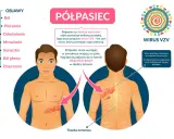 Objawy półpaśca: ból, pieczenie, gorączka. Jak złagodzić ból przy półpaścu? Infekcja wirusem VZV powoduje bolesną wysypkę.