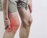Mężczyzna trzyma się za udo, gdzie widoczny jest czerwony obszar bólu nogi pod kolanem.