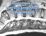 Obraz rezonansu magnetycznego kręgosłupa lędźwiowego, ilustrujący proces rehabilitacji po operacji.
