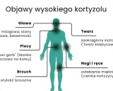 Objawy wysokiego kortyzolu: mgła mózgowa, garb, otyłość brzuszna, księżycowata twarz, osłabienie mięśni.