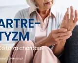 Starsza kobieta trzyma się za nadgarstek, cierpiąc na artretyzm. Napis: "ARTRETYZM. Co to za choroba?".