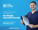 Uśmiechnięty lekarz w granatowym uniformie trzyma prześwietlenie stopy, prezentując, jak wygląda operacja haluksa metodą MICA bez długiej rekonwalescencji.