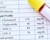 Wyniki lipidogramu: cholesterol 175, trójglicerydy 40, HDL-C 89, LDL-C 76 mg/dL.