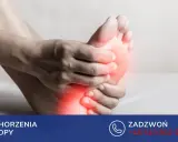 Dłoń uciska bolącą stopę, zaznaczoną czerwonymi plamami bólu.