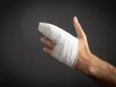 Dłoń z zabandażowanym palcem, który wygląda na wybity.