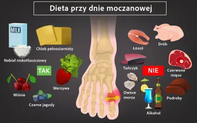 Dieta przy dnie moczanowej: nabiał, chleb, warzywa, owoce (TAK); ryby, drób, czerwone mięso, podroby, alkohol (NIE).