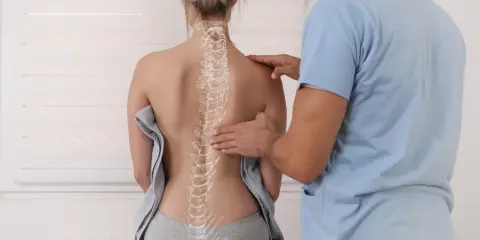 Fizjoterapeuta bada kręgosłup pacjentki, zwracając uwagę na potencjalną kifoza piersiowa.