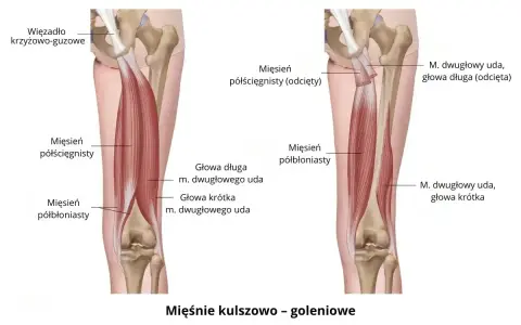 Anatomia mięśni kulszowo-goleniowych, które mogą powodować ból mięśni. Widoczne więzadło krzyżowo-guzowe i mięśnie: półścięgnisty i półbłoniasty.