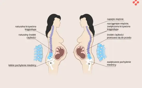 Zmiany w kręgosłupie w ciąży: naturalna krzywizna vs. zwiększona, przesunięty środek ciężkości. Choroby ginekologiczne a ból kręgosłupa.