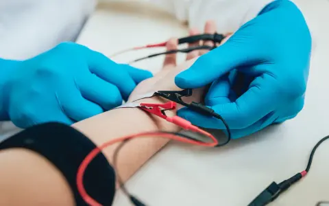 Badanie EMG, czyli elektromiografia, to badanie oceniające funkcję nerwów i mięśni. Na zdjęciu widać elektrody podłączone do ręki pacjenta.