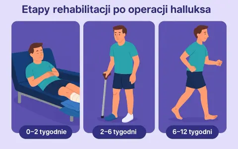 Etapy rehabilitacji po operacji haluksa: odpoczynek (0-2 tyg.), chodzenie o kulach (2-6 tyg.), powrót do aktywności (6-12 tyg.).