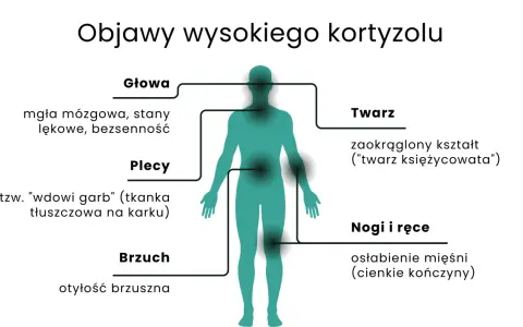 Objawy wysokiego kortyzolu: mgła mózgowa, garb, otyłość brzuszna, księżycowata twarz, osłabienie mięśni.