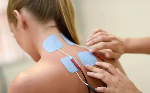 Elektrody na plecach kobiety, podłączone do urządzenia. To przykład, co to jest fizjoterapia – rehabilitacja i leczenie bólu.