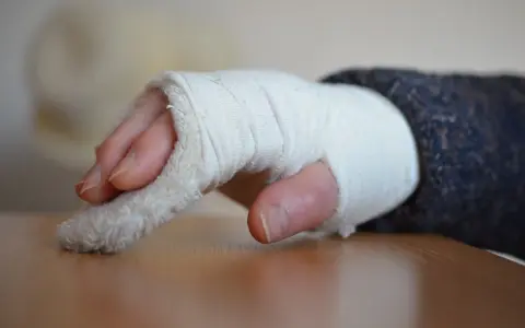 Złamany nadgarstek w bandażu. Czas rehabilitacji po złamaniu nadgarstka jest kluczowy dla powrotu do sprawności.