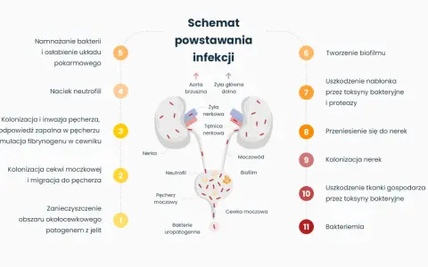 Schemat powstawania infekcji dróg moczowych, od kolonizacji bakterii po zapalenie pęcherza i nerek. Leki mogą pomóc w leczeniu tego stanu.
