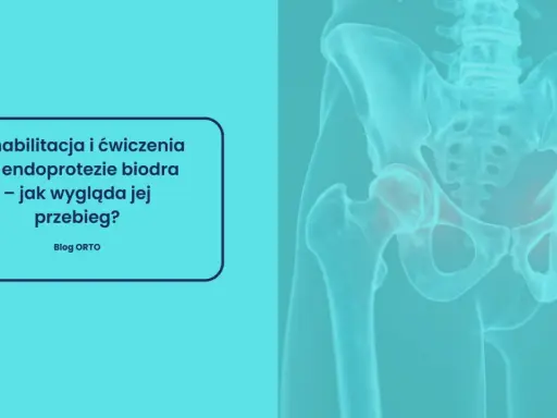 Rehabilitacja po endoprotezie stawu biodrowego: jak długo trwa i jak wygląda jej przebieg? Grafika przedstawia miednicę i staw biodrowy.