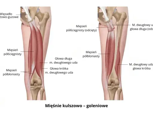 Anatomia mięśni kulszowo-goleniowych, które mogą powodować ból mięśni. Widoczne więzadło krzyżowo-guzowe i mięśnie: półścięgnisty i półbłoniasty.