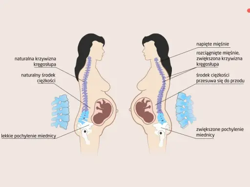 Zmiany w kręgosłupie w ciąży: naturalna krzywizna vs. zwiększona, przesunięty środek ciężkości. Choroby ginekologiczne a ból kręgosłupa.