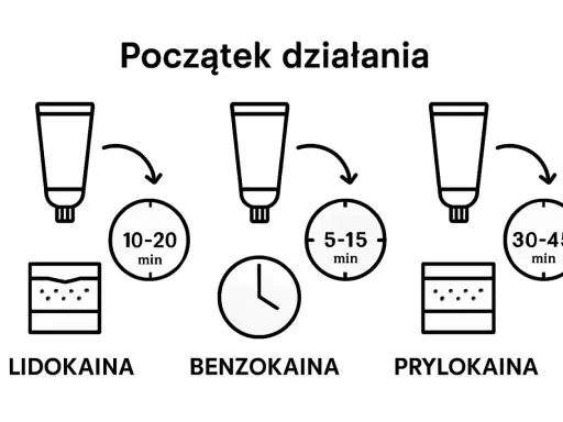 Porównanie czasu działania: lidokaina (10-20 min), benzokaina (5-15 min), prylokaina (30-45 min).