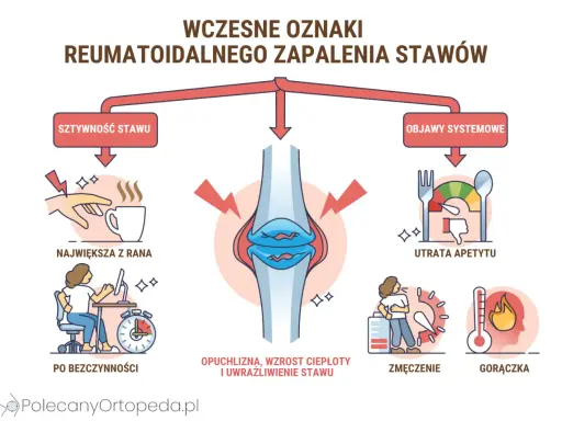 Wczesne oznaki reumatoidalnego zapalenia stawów: sztywność, opuchlizna, zmęczenie, gorączka, utrata apetytu. Test na RZS.