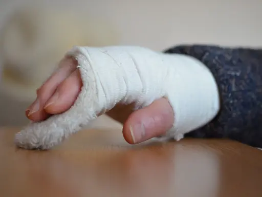 Złamany nadgarstek w bandażu. Czas rehabilitacji po złamaniu nadgarstka jest kluczowy dla powrotu do sprawności.