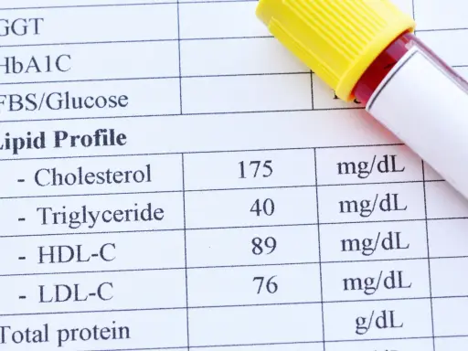 Wyniki lipidogramu: cholesterol 175, trójglicerydy 40, HDL-C 89, LDL-C 76 mg/dL.