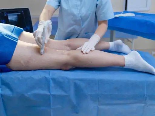 Badanie dopplerowskie żył kończyn dolnych. Lekarz wykonuje USG, oceniając przepływ krwi.