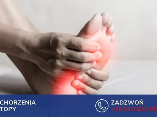 Dłoń uciska bolącą stopę, zaznaczoną czerwonymi plamami bólu.