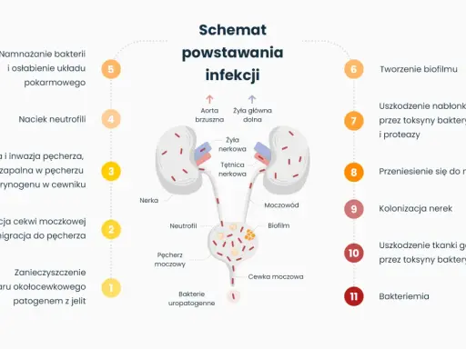 Schemat powstawania infekcji dróg moczowych, od kolonizacji bakterii po zapalenie pęcherza i nerek. Leki mogą pomóc w leczeniu tego stanu.