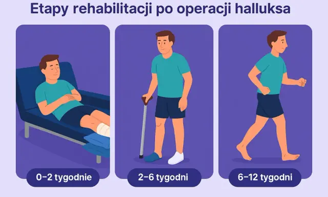 Etapy rehabilitacji po operacji haluksa: odpoczynek (0-2 tyg.), chodzenie o kulach (2-6 tyg.), powrót do aktywności (6-12 tyg.).