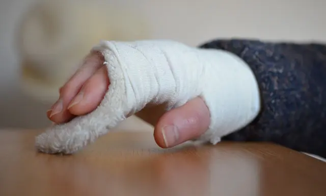 Złamany nadgarstek w bandażu. Czas rehabilitacji po złamaniu nadgarstka jest kluczowy dla powrotu do sprawności.