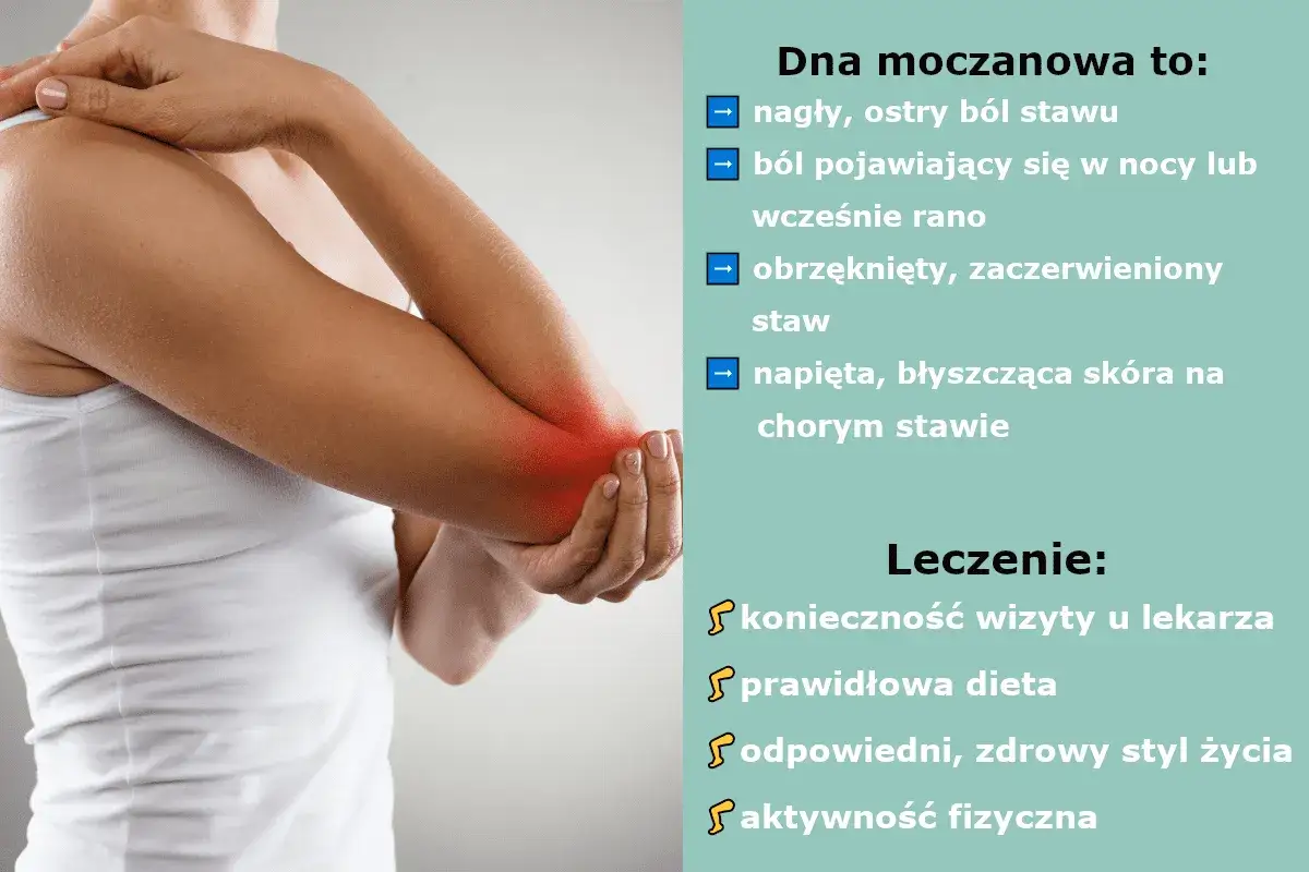 Dna moczanowa – objawy skórne: zaczerwieniony, obrzęknięty staw łokciowy z bólem. Leczenie: wizyta u lekarza, dieta, zdrowy styl życia.