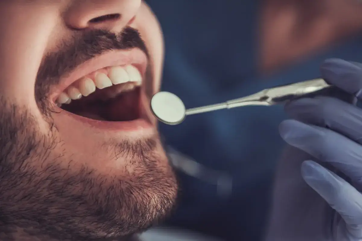 Pacjent z bólem zęba w Koninie u dentysty. Badanie jamy ustnej lusterkiem stomatologicznym.