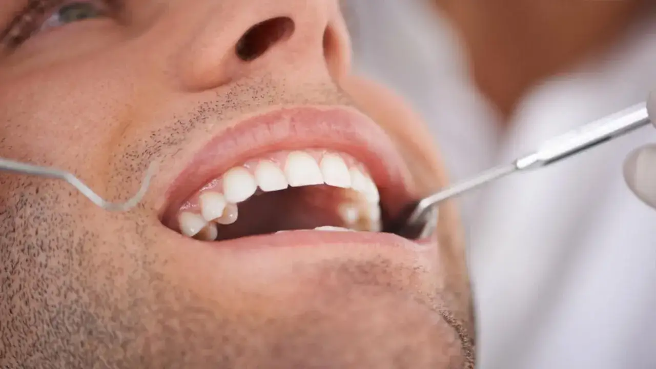 Mężczyzna z bólem zęba w Koninie u dentysty. Badanie jamy ustnej narzędziami stomatologicznymi.