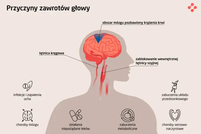 Ilustracja przedstawia przyczyny zawrotów głowy, w tym problemy z krążeniem mózgowym, infekcje ucha, choroby mózgu, zaburzenia metaboliczne i sercowo-naczyniowe.